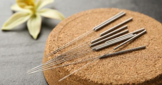 Acupuncture